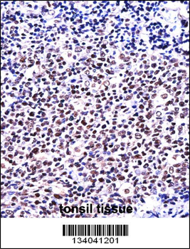 NFATC1 Antibody (C-term)