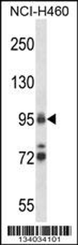 TOP1 Antibody (N-term)