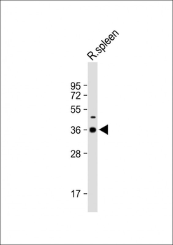 DNASE1L3 Antibody (N-term)