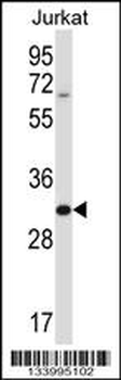 HRASLS5 Antibody (Center)