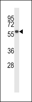 PPM1D Antibody (Center)