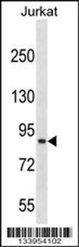 CUL4A Antibody (N-term)