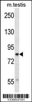 CUL4A Antibody (N-term)