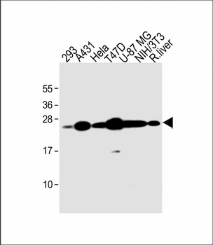 RAB1B Antibody (C-term)