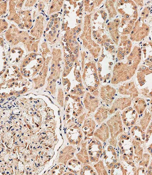 RAB1B Antibody (C-term)