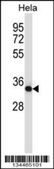 Mouse Csnk2a2 Antibody (N-term)
