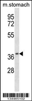 Mouse Csnk2a2 Antibody (N-term)