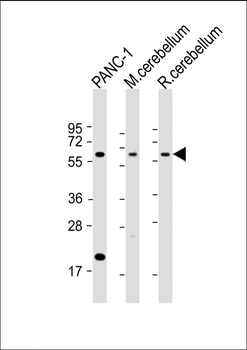 SLC11A2 Antibody (Center)
