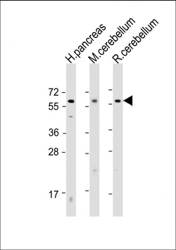 SLC11A2 Antibody (Center)