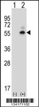 Mouse Camk2d Antibody (Center)