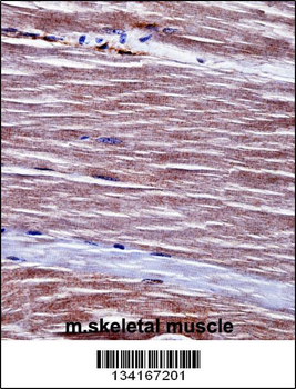 Mouse Acvr1 Antibody (Center)