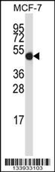 GDI2 Antibody (Center)