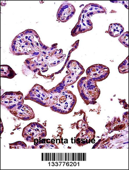 RIPK2 Antibody (N-term)