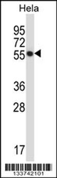 CSK Antibody (N-term)