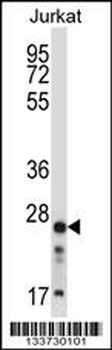 ARHGDIB Antibody (C-term)