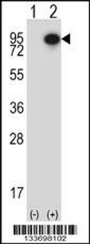 CTTN Antibody (Center)