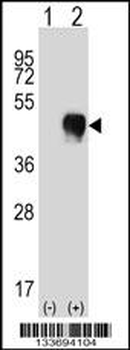 FCGR2A Antibody (C-term)