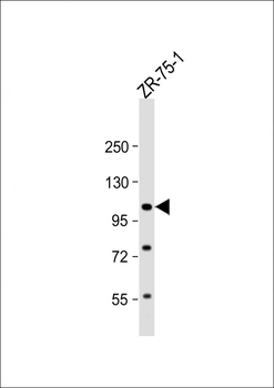 FOLH1 Antibody (N-term)