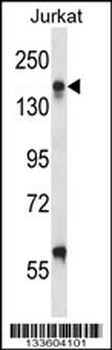 ITGAL Antibody (Center)
