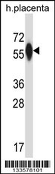 P4HA3 Antibody (Center)
