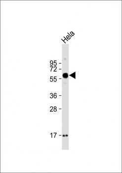 SMOC1 Antibody (C-term)