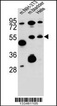 SMOC1 Antibody (C-term)