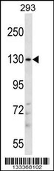 PITPNM2 Antibody (Center)
