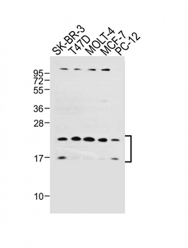 UBE2W Antibody (C-term)