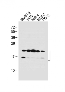 UBE2W Antibody (C-term)