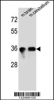 SYP Antibody (C-term)