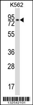 REC8 Antibody (Center)