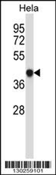 GRINA Antibody (Center)