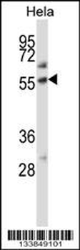 ALPP Antibody (Center)