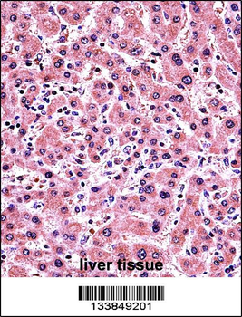 ALPP Antibody (Center)