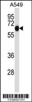 ALPPL2 Antibody (N-term)