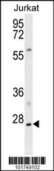 PHO1 Antibody (N-term)
