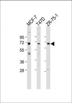 ESR1/ER Antibody (Center)