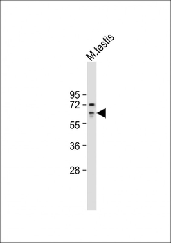 ESR1/ER Antibody (Center)