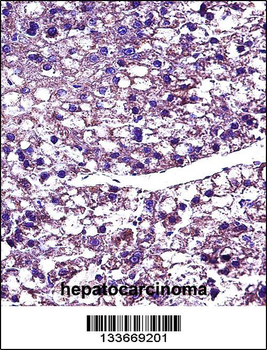 PROC Antibody (Center)