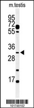 APOBEC3B Antibody (C-term)