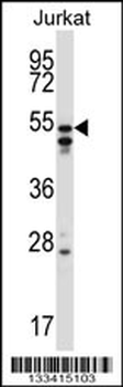 HNRNPH2 Antibody (C-term)