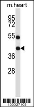 DTX3 Antibody (N-term )