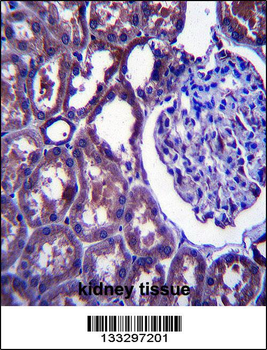 NPC1 Antibody (Center)