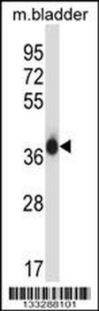 EIF2S1 Antibody (N-term)