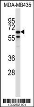 TRIM39 Antibody (Center)