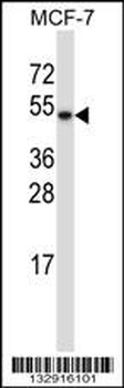 TXNDC15 Antibody (C-term)