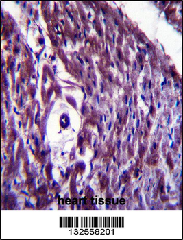 MAGED4B Antibody (Center)