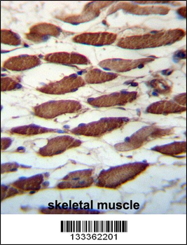 USP45 Antibody (Center)