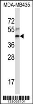 RPL3 Antibody (Center)
