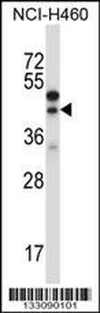 CTGF Antibody (Center)